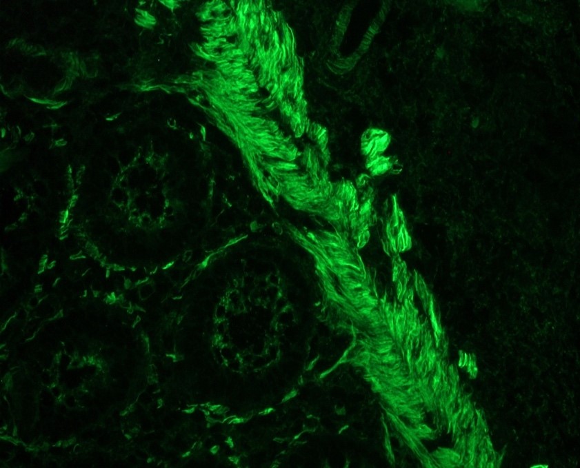 Figure 4. Smooth muscle cells in swine colon as detected by MUB1700P (R4A; dilution 1:100).